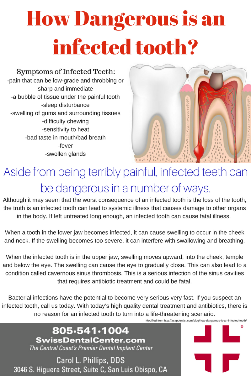 How Dangerous Is An Infected Tooth? Swiss Dental Center