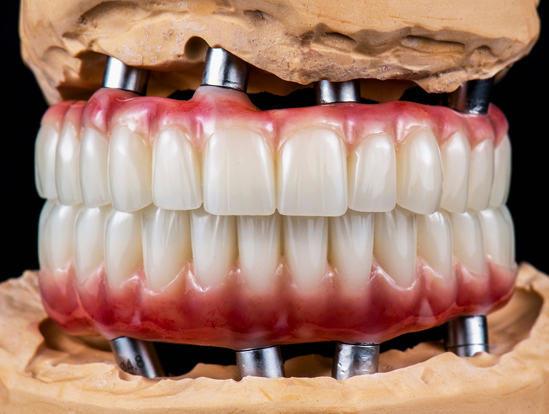 A Comprehensive Solution for Your Smile